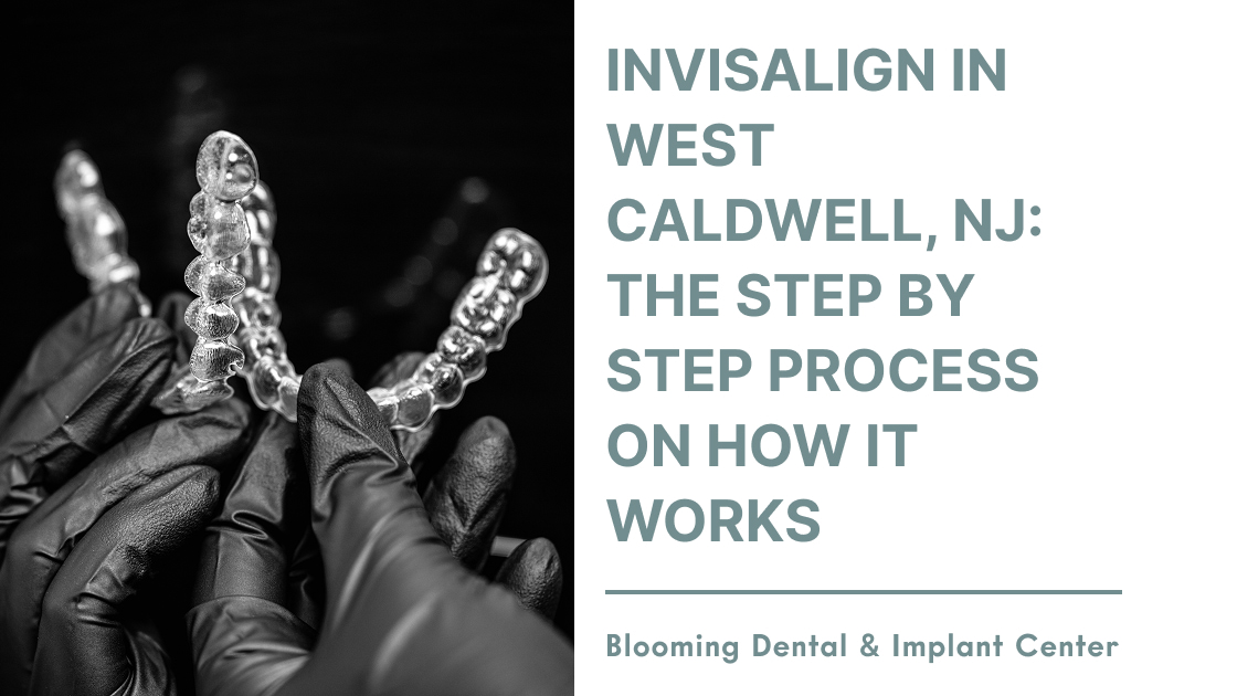 Invisalign in West Caldwell & Rockaway: The Step by Step Process on How It Works