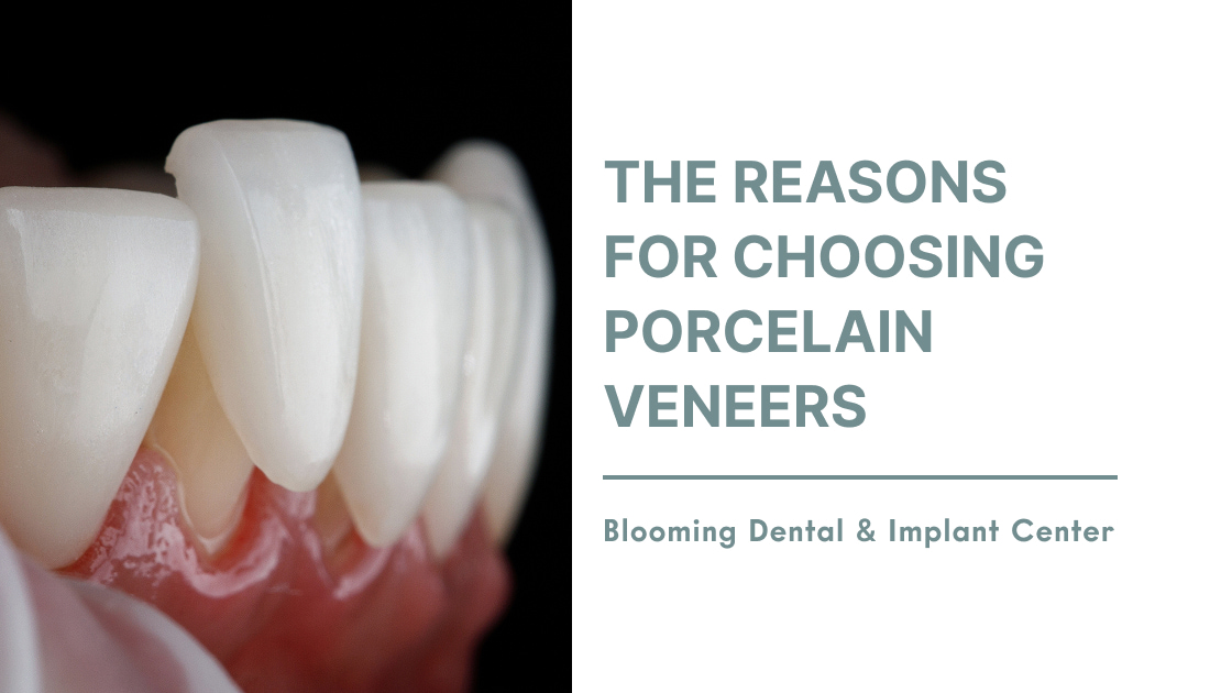 The Reasons for Choosing Porcelain Veneers