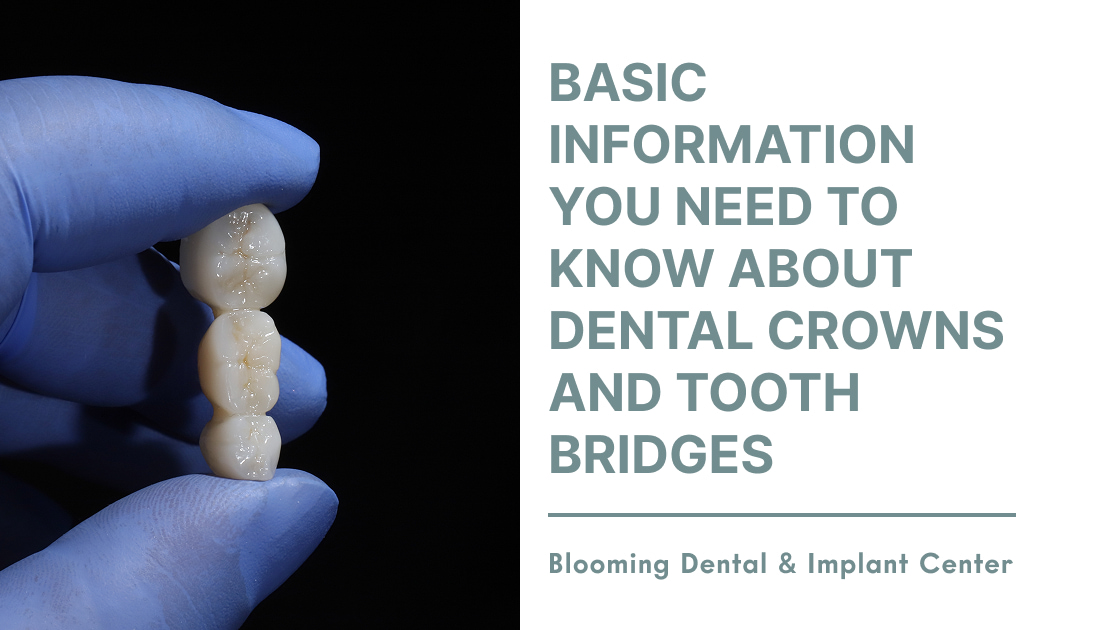 Basic Information You Need to Know About Dental Crowns and Tooth Bridges