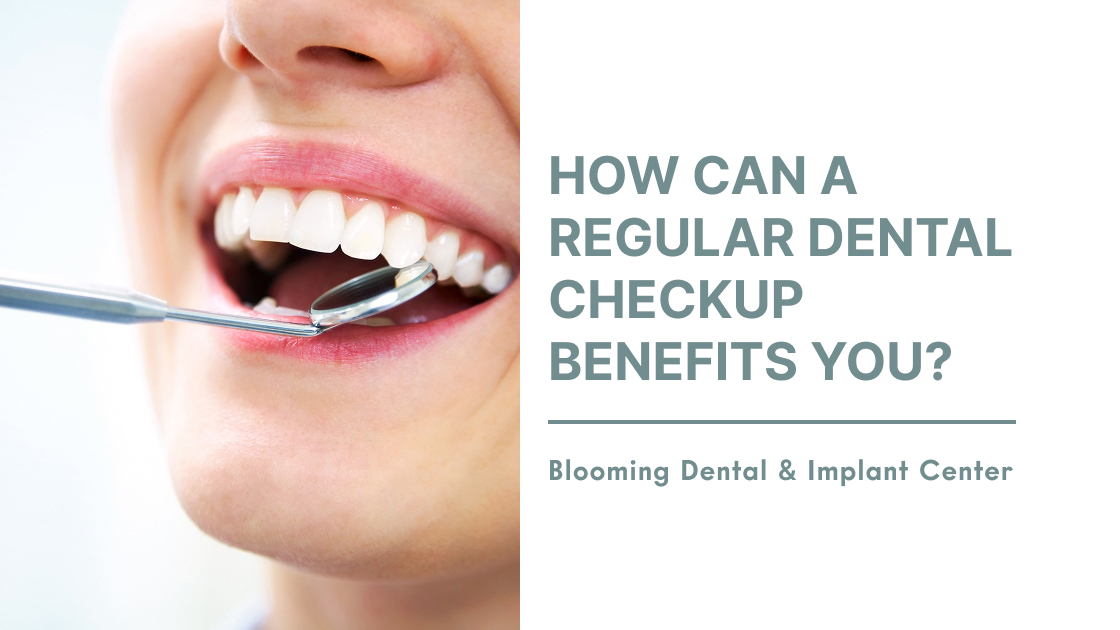 How Can A Regular Dental Checkup Benefits You?