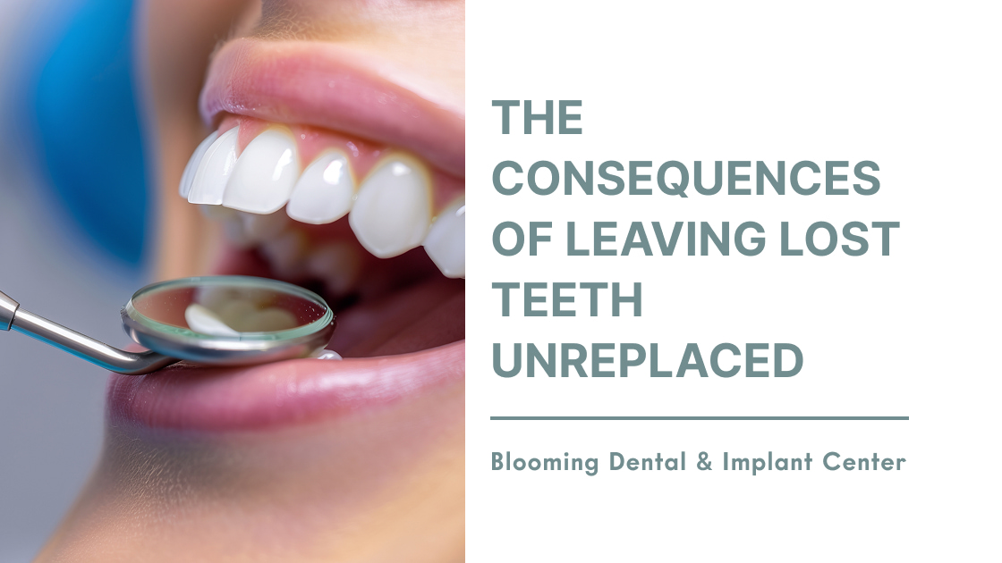 The Consequences of Leaving Lost Teeth Unreplaced