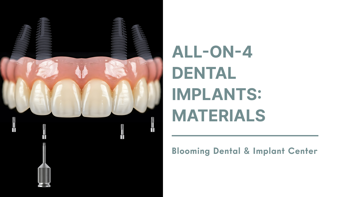 All-On-4 Dental Implants: Materials