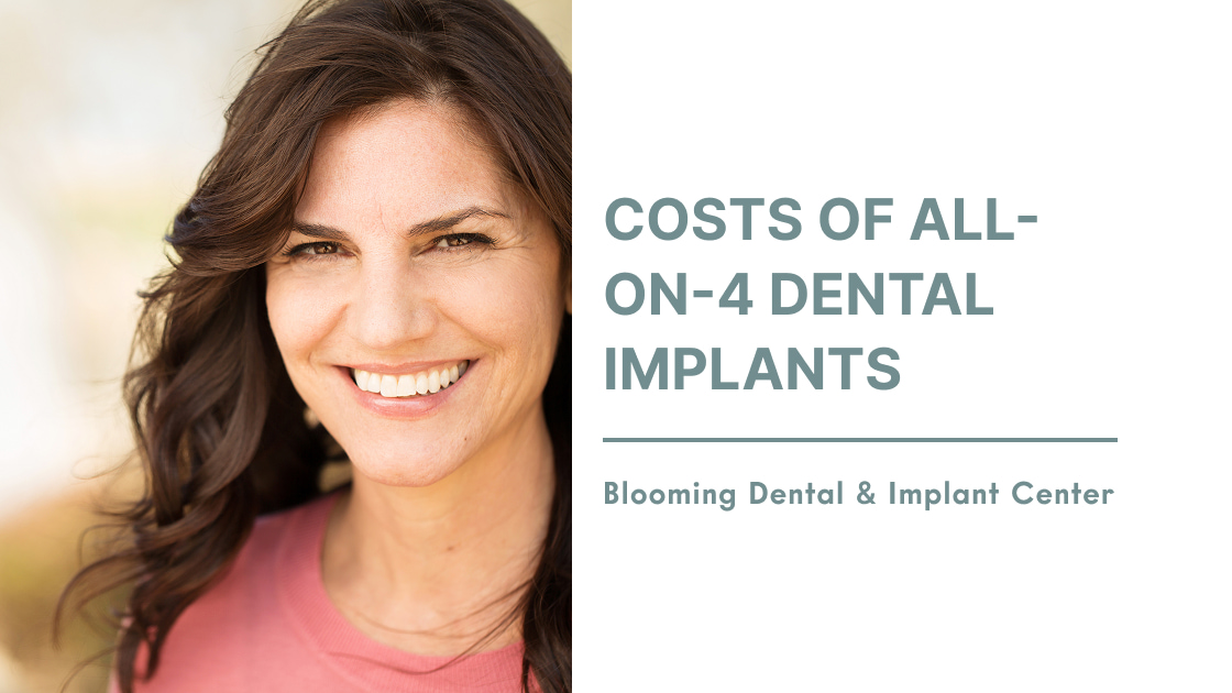 Costs of All-On-4 Dental Implants