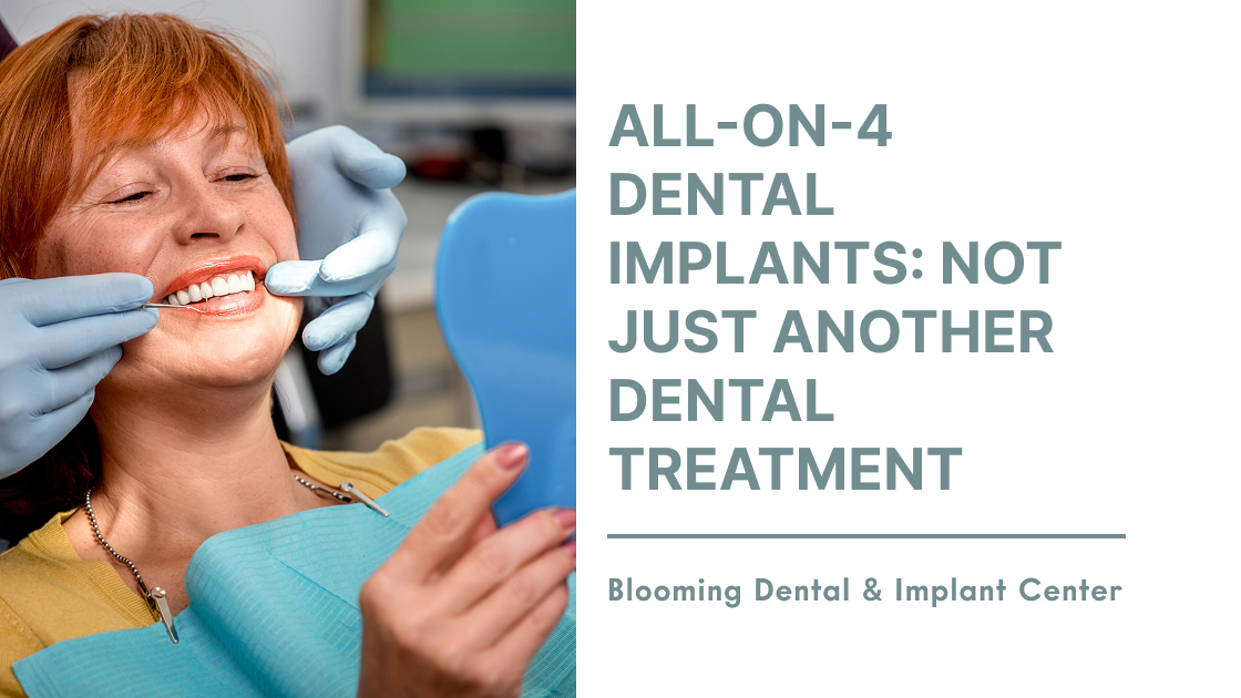 All-On-4 Dental Implants: Not Just Another Dental Treatment