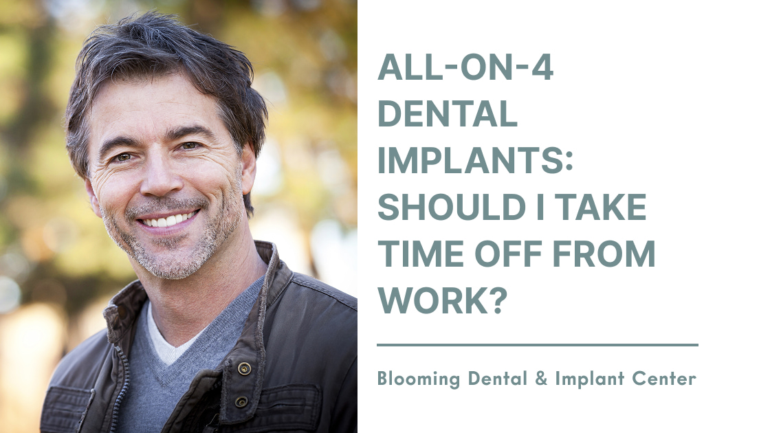 All-On-4 Dental Implants: Should I Take Time Off From Work?