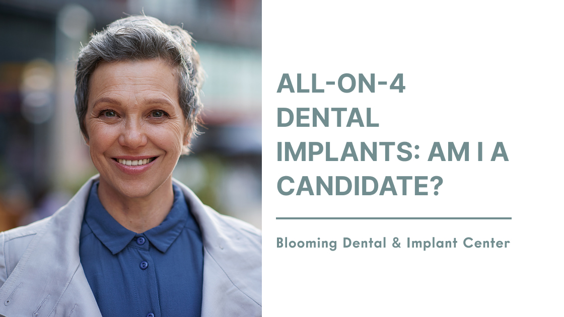 All-On-4 Dental Implants: Am I a Candidate?