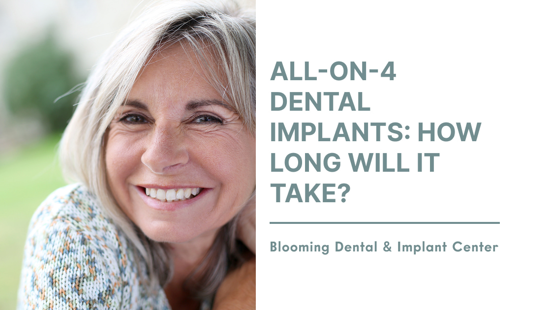 All-On-4 Dental Implants: How Long Will It Take?