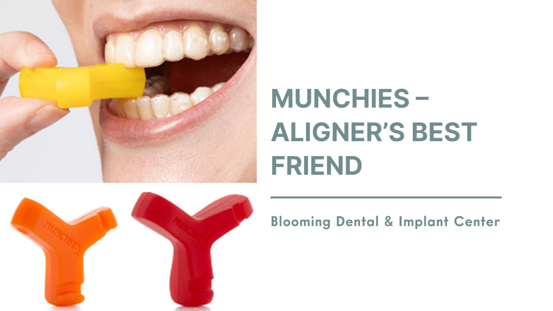 Munchies - Aligner's Best Friend