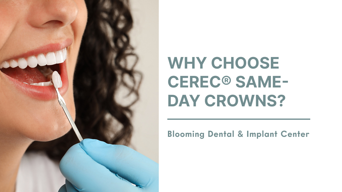 Why Choose CEREC® Same-Day Crowns?