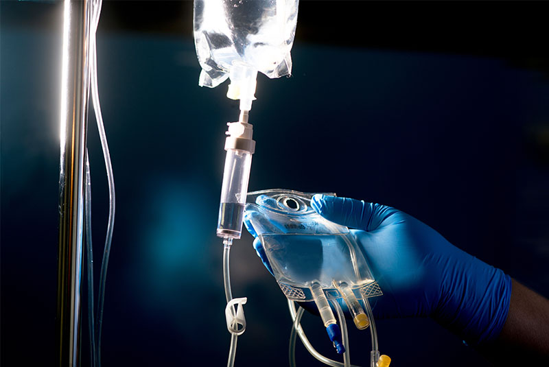 IV Sedation Dentistry
