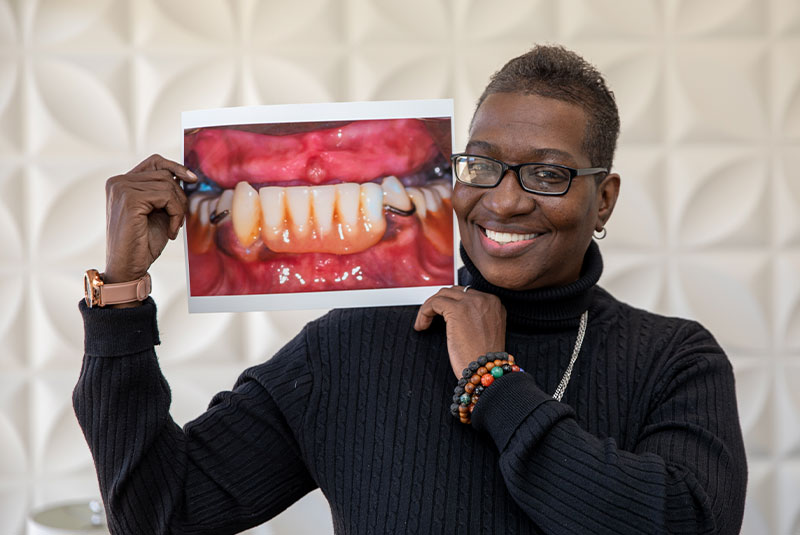 Full Set of Functional Teeth image