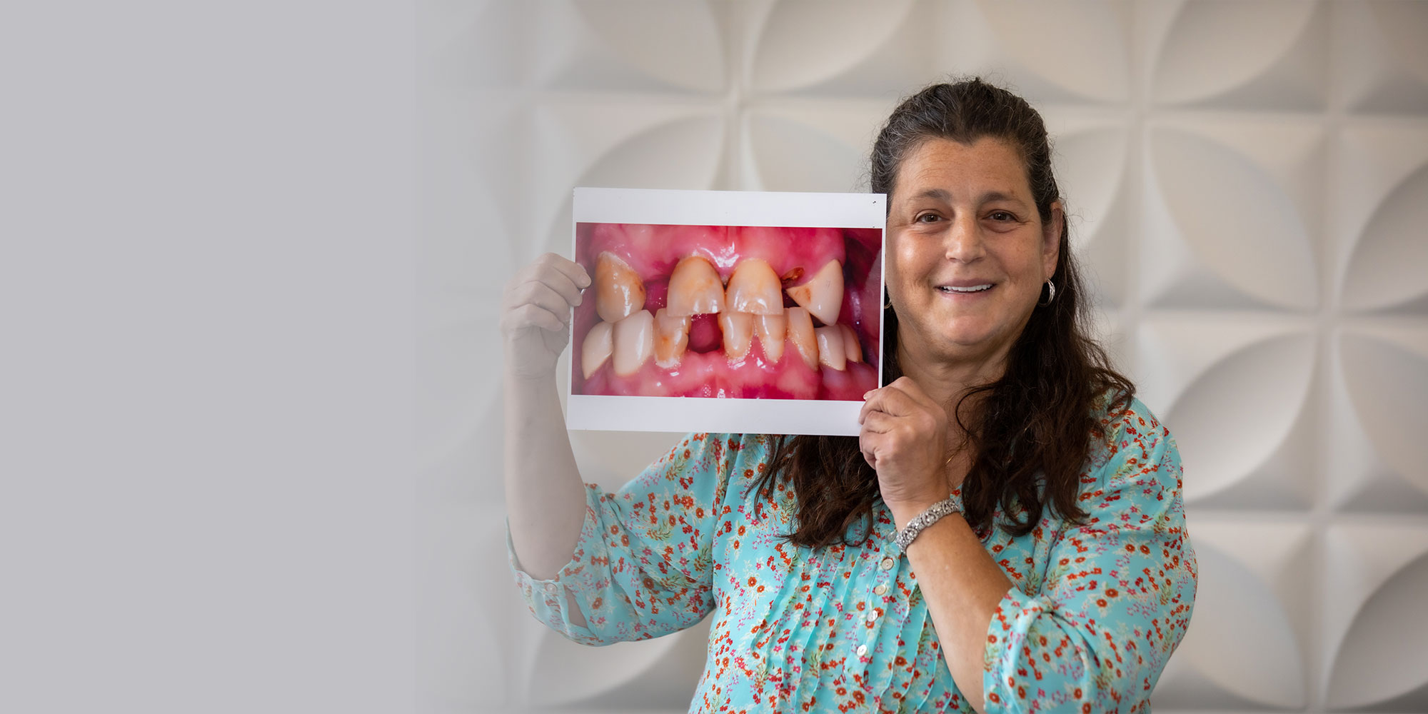 BEFORE & AFTER Banner