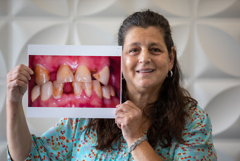 the Comprehensive Rejuvenation Dentistry image