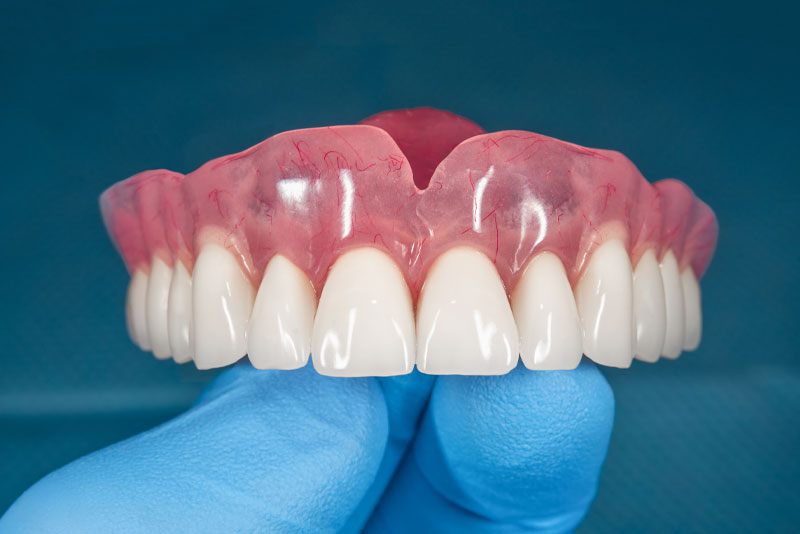 Traditional Dentures