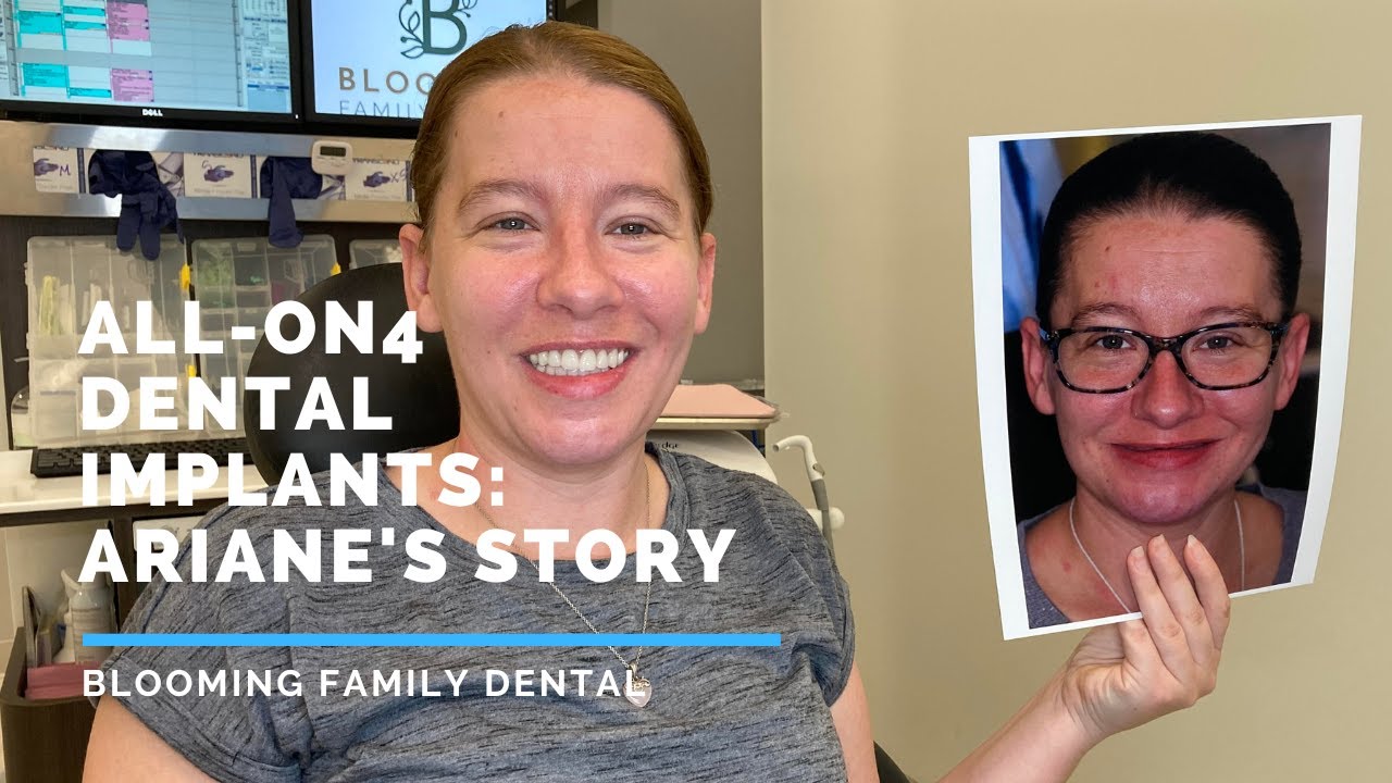 all on 4 dental patient