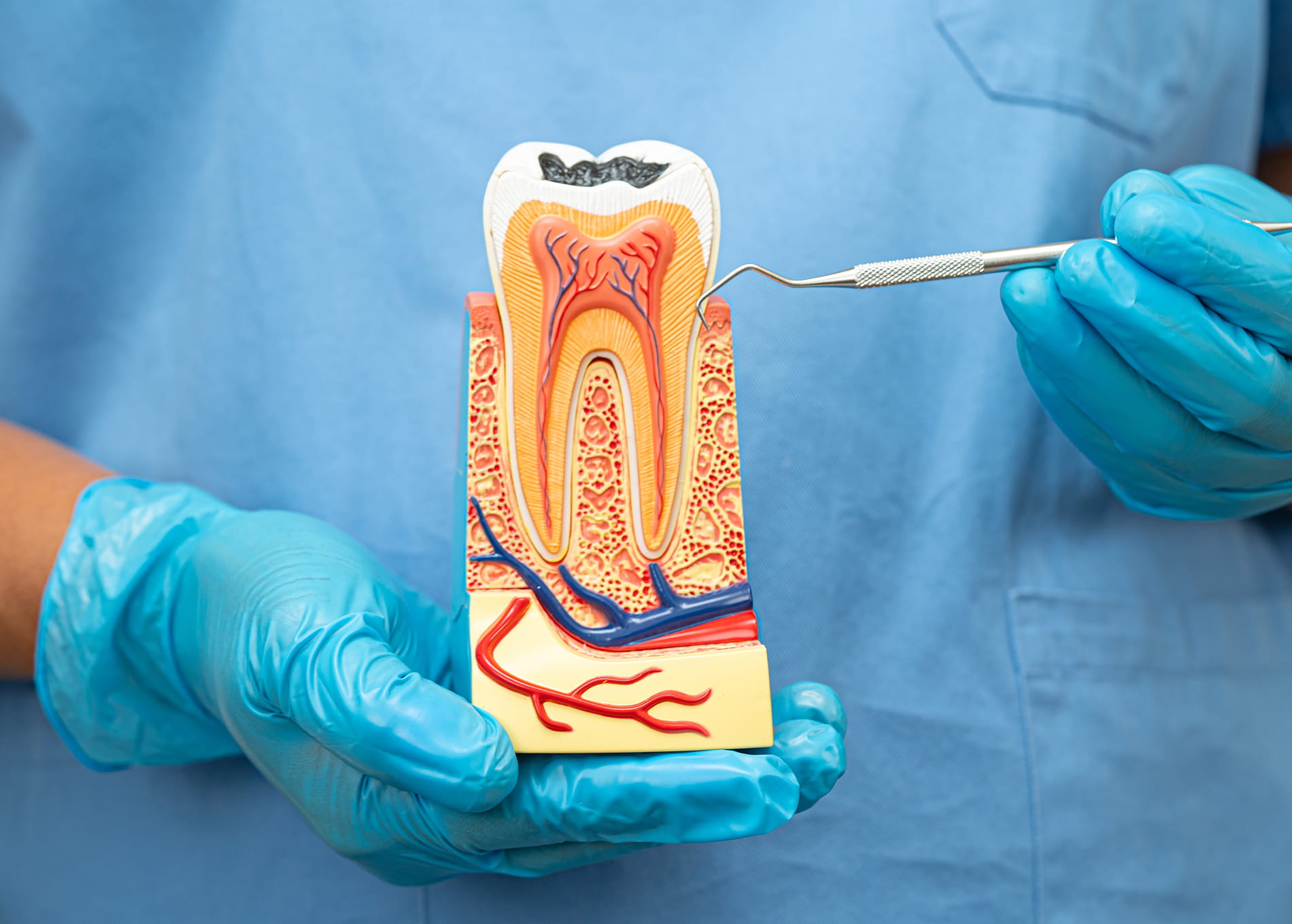 Advanced root canal treatment to relieve tooth pain