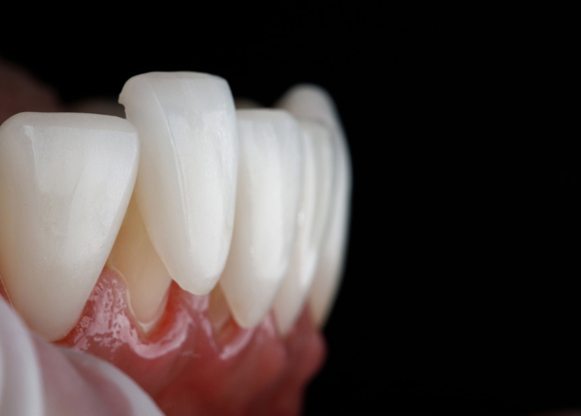 Same-day CEREC crowns in West Caldwell & Rockaway